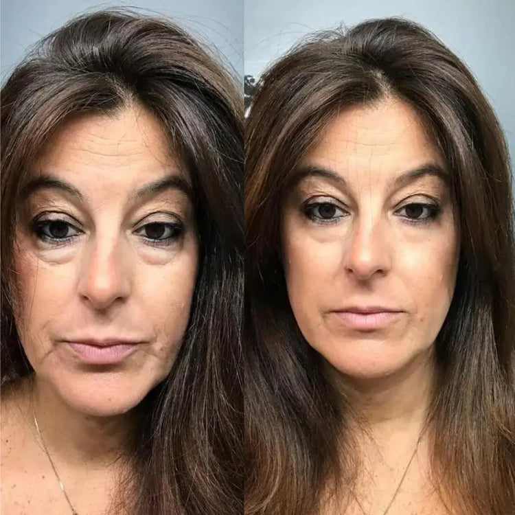 Perfection Eye Tightener