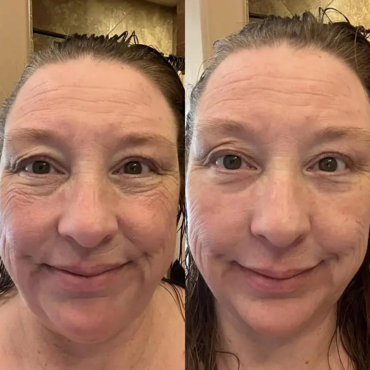 Perfection Eye Tightener